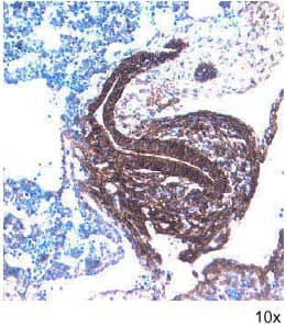 Immunohistochemistry Frizzled-7 Antibody [Unconjugated]