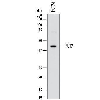 Western Blot Fucosyltransferase 7/FUT7 Antibody (795116)