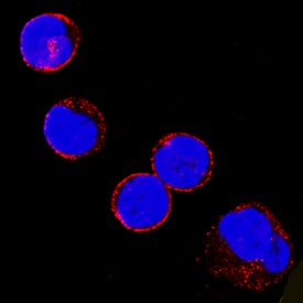 Fyn was detected in immersion fixed human peripheral blood mononuclear cells (PBMCs) using Mouse Anti-Human/Mouse/Rat Fyn Monoclonal Antibody (Catalog # MAB3574) at 8 µg/mL for 3 hours at room temperature. Cells were stained using the NorthernLights™ 557-conjugated Anti-Mouse IgG Secondary Antibody (red; Catalog # NL007) and counterstained with DAPI (blue). Specific staining was localized to cytoplasm and nuclei. View our protocol for Fluorescent ICC Staining of Non-adherent Cells.