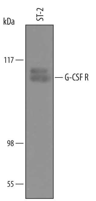 Western blot shows lysates of ST-2 mouse bone marrow-derived stromal cell line. PVDF Membrane was probed with 0.1 µg/mL of Sheep Anti-Mouse G-CSF R/CD114 Antigen Affinity-purified Polyclonal Antibody (Catalog # AF6039) followed by HRP-conjugated Anti-Sheep IgG Secondary Antibody (Catalog # HAF016). A specific band was detected for G-CSF R/CD114 at approximately 110 and 112 kDa (as indicated). This experiment was conducted under reducing conditions and using Immunoblot Buffer Group 8.