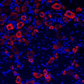 GABABR1 was detected in perfusion fixed frozen sections of rat brain (dorsal root ganglia) using Sheep Anti-Mouse/Rat GABABR1 Antigen Affinity-purified Polyclonal Antibody (Catalog # AF7000) at 1.7 µg/mL overnight at 4 °C. Tissue was stained using the Northern-Lights™ 557-conjugated Anti-Sheep IgG Secondary Antibody (red; Catalog # NL010) and counterstained with DAPI (blue). Specific staining was localized to the cell bodies of dorsal root ganglia neurons. View our protocol for Fluorescent IHC Staining of Frozen Tissue Sections.