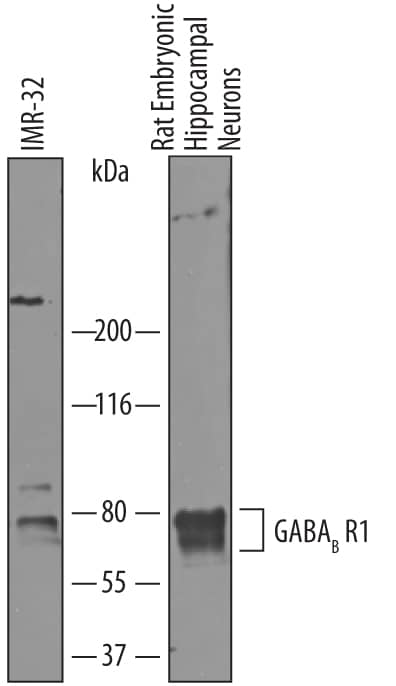 Western blot shows lysates of IMR-32 human neuroblastoma cell line and rat embryonic hippocampal neurons. PVDF membrane was probed with 1 µg/mL of Sheep Anti-Mouse/Rat GABABR1 Antigen Affinity-purified Polyclonal Antibody (Catalog # AF7000) followed by HRP-conjugated Anti-Sheep IgG Secondary Antibody (Catalog # HAF016). Specific bands were detected for GABABR1 at approximately 70-80 kDa (as indicated). This experiment was conducted under reducing conditions and using Immunoblot Buffer Group 1.