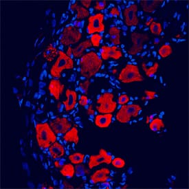 GABABR1 was detected in perfusion fixed frozen sections of rat trigeminal ganglia using Mouse Anti-Rat GABABR1 Mono-clonal Antibody (Catalog # MAB7000) at 25 µg/mL overnight at 4 °C. Tissue was stained using the NorthernLights™ 557-conjugated Anti-Mouse IgG Secondary Antibody (red; Catalog # NL007) and counterstained with DAPI (blue). Specific staining was localized to plasma membranes and cytoplasm of sensory neurons. View our protocol for Fluorescent IHC Staining of Frozen Tissue Sections.