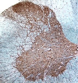 GABABR2 was detected in perfusion fixed frozen sections of rat spinal cord using Goat Anti-Rat GABABR2 N-Terminus Antigen Affinity-purified Polyclonal Antibody (Catalog # AF1188) at 15 µg/mL for 1 hour at room temperature followed by incubation with the Anti-Goat IgG VisUCyte™ HRP Polymer Antibody (Catalog # VC004). Tissue was stained using DAB (brown) and counterstained with hematoxylin (blue). Specific staining was localized to dorsal horn. View our protocol for IHC Staining with VisUCyte HRP Polymer Detection Reagents.
