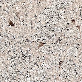 Immunohistochemistry GABA-B R2 Antibody (2605C) [Unconjugated]