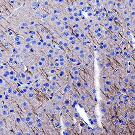 Immunohistochemistry GABA-B R2 Antibody (2605C) [Unconjugated]