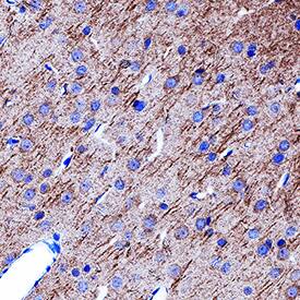 Immunohistochemistry GABA-B R2 Antibody (2605C) [Unconjugated]