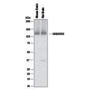 Western Blot GABA-B R2 Antibody (2605C) [Unconjugated]