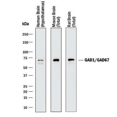 Western Blot GAD1/GAD67 Antibody [Unconjugated]
