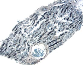 Immunohistochemistry GAD2/GAD65 Antibody [Unconjugated]