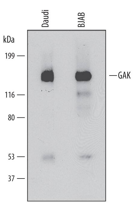 Western blot shows lysates of Daudi human Burkitt's lymphoma cell line and BJAB human Burkitt's lymphoma cell line. PVDF membrane was probed with 1 µg/mL of Mouse Anti-Human GAK Monoclonal Antibody (Catalog # MAB6918) followed by HRP-conjugated Anti-Mouse IgG Secondary Antibody (Catalog # HAF007). A specific band was detected for GAK at approximately 144 kDa (as indicated). This experiment was conducted under reducing conditions and using Immunoblot Buffer Group 1.
