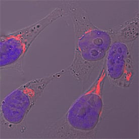 Immunocytochemistry GALNT2 Antibody