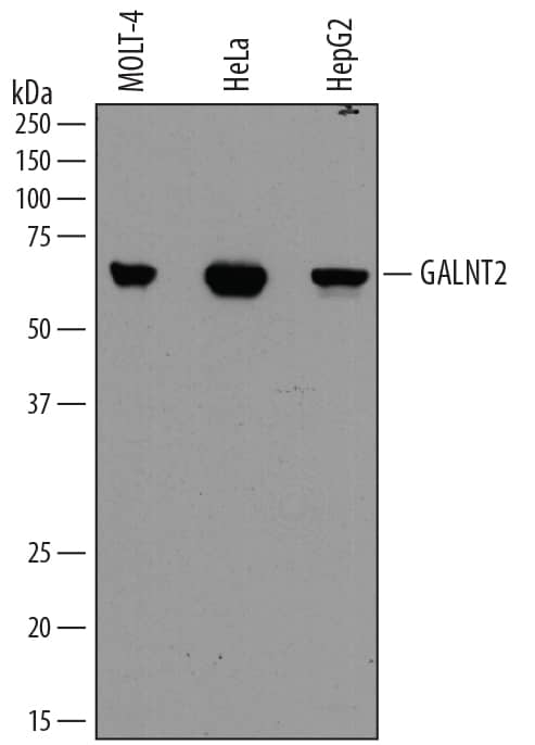 Western Blot GALNT2 Antibody