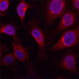 Immunocytochemistry Polypeptide GalNac Transferase 3/GALNT3 Antibody