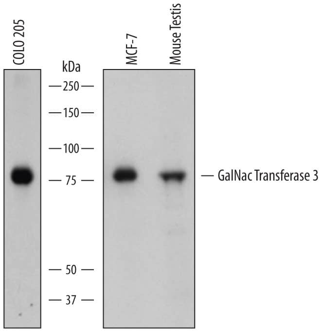 Western Blot Polypeptide GalNac Transferase 3/GALNT3 Antibody
