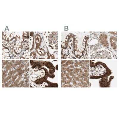 Immunohistochemistry-Paraffin: GALT Antibody [NBP1-86133] - Staining of human colon, kidney, liver and placenta using Anti-GALT antibody NBP1-86133 (A) shows similar protein distribution across tissues to independent antibody NBP1-86138 (B).