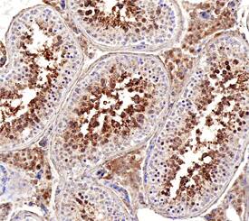 GAPDH-2 was detected in immersion fixed paraffin-embedded sections of human testes using Goat Anti-Human GAPDH-2 Antigen Affinity-purified Polyclonal Antibody (Catalog # AF6276) at 3 µg/mL overnight at 4 °C. Before incubation with the primary antibody, tissue was subjected to heat-induced epitope retrieval using Antigen Retrieval Reagent-Basic (Catalog # CTS013). Tissue was stained using the Anti-Goat HRP-DAB Cell & Tissue Staining Kit (brown; Catalog # CTS008) and counterstained with hematoxylin (blue). Specific staining was localized to cytoplasm of sperm cells. View our protocol for Chromogenic IHC Staining of Paraffin-embedded Tissue Sections.