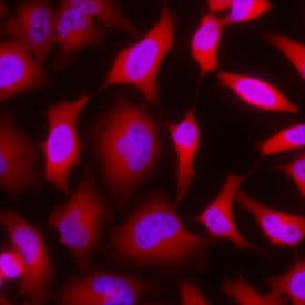GAPDH was detected in immersion fixed HeLa human cervical epithelial carcinoma cell line using Goat Anti-Human/Mouse/Rat GAPDH Antigen Affinity-purified Polyclonal Antibody (Catalog # AF5718) at 5 µg/mL for 3 hours at room temperature. Cells were stained using the NorthernLights™ 557-conjugated Anti-Goat IgG Secondary Antibody (red; NL001) and counterstained with DAPI (blue). View our protocol for Fluorescent ICC Staining of Cells on Coverslips.