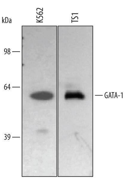 Western blot shows lysates of K562 human chronic myelogenous leukemia cell line and TS1 mouse helper T cell line. PVDF membrane was probed with 0.5 µg/mL of Human GATA-1 Antigen Affinity-purified Polyclonal Antibody (Catalog # AF1779) followed by HRP-conjugated Anti-Goat IgG Secondary Antibody (Catalog # HAF017). A specific band was detected for GATA-1 at approximately 50 kDa (as indicated). This experiment was conducted using Immunoblot Buffer Group 1.