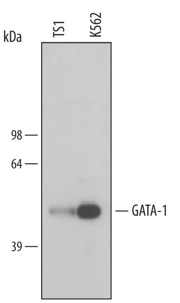 Western blot shows lysates of TS1 mouse helper T cell line and K562 human chronic myelogenous leukemia cell line. PVDF membrane was probed with 0.5 µg/mL of Human/Mouse GATA-1 Monoclonal Antibody (Catalog # MAB17791) followed by HRP-conjugated Anti-Rat IgG Secondary Antibody (Catalog # HAF005). A specific band was detected for GATA-1 at approximately 45 kDa (as indicated). This experiment was conducted under reducing conditions and using Immunoblot Buffer Group 4.