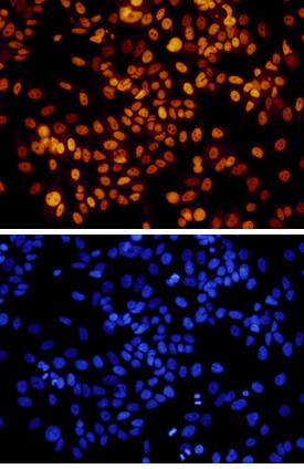 GATA-3 was detected in immersion fixed MCF-7 human breast cancer cell line using 10 µg/mL Goat Anti-Human GATA-3 Biotinylated Antigen Affinity-purified Polyclonal Antibody (Catalog # BAF2605) for 3 hours at room temperature. Cells were stained with the Northern-Lights™ 557-conjugated Streptavidin (red, upper panel; Catalog # NL999) and counterstained with DAPI (blue, lower panel). View our protocol for Fluorescent ICC Staining of Cells on Coverslips.
