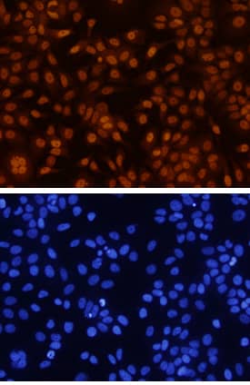 GATA‑3 was detected in immersion fixed MCF-7 human breast cancer cell line using 10 &micro;g/mL Human GATA‑3 Monoclonal Antibody (Catalog # MAB26051) for 3 hours at room temperature. Cells were stained with the NorthernLights&trade; 557-conjugated Anti-Mouse IgG Secondary Antibody (red, upper panel; Catalog # NL007) and counterstained with DAPI (blue, lower panel). View our protocol for Fluorescent ICC Staining of Cells on Coverslips.