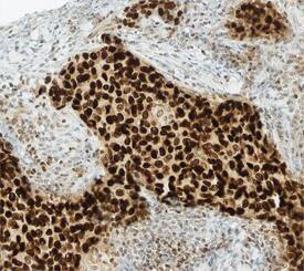 Immunohistochemistry GATA-3 Antibody (634913) [Unconjugated]