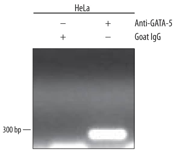 Chromatin Immunoprecipitation (ChIP) GATA-5 Antibody [Unconjugated]