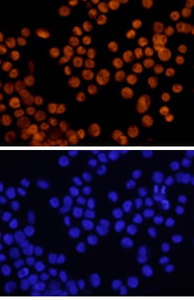 GATA‑6 was detected in immersion fixed KATO-III human gastric carcinoma cell line using 10 &micro;g/mL Human GATA‑6 Biotinylated Antigen Affinity-purified Polyclonal Antibody (Catalog # BAF1700) for 3 hours at room temperature. Cells were stained with the NorthernLights&trade; 557-conjugated Streptavidin (red, upper panel; Catalog # <a class=