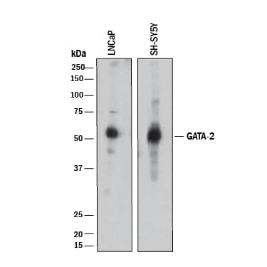 Western blot shows lysates of LNCaP human prostate cancer cell line and SH-SY5Y human neuroblastoma cell line. PVDF membrane was probed with 0.5 µg/mL of Goat Anti-Human/Mouse GATA-2 Antigen Affinity-purified Polyclonal Antibody (Catalog # AF2046) followed by HRP-conjugated Anti-Goat IgG Secondary Antibody (Catalog # HAF017). A specific band was detected for GATA-2 at approximately 55 kDa (as indicated). This experiment was conducted under reducing conditions and using Immunoblot Buffer Group 1.