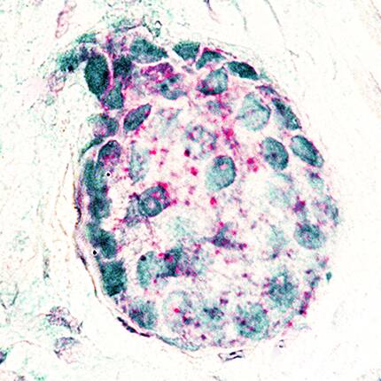 Dual RNAscope ISH-IHC Compatible GATA-3 Antibody (634913) [Unconjugated]