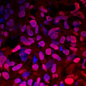 GATA-4 was detected in immersion fixed iBJ6, an induced pluripotent stem cell line, differentiated to endoderm using Goat Anti-Human GATA-4 Biotinylated Antigen Affinity-purified Polyclonal Antibody (Catalog # BAF2606) at 10 µg/mL for 3 hours at room temperature. Cells were stained using the NorthernLights™ 557-conjugated Streptavidin (red; Catalog # NL999) and counterstained with DAPI (blue). Specific staining was localized to nuclei. View our protocol for Fluorescent ICC Staining of Stem Cells on Coverslips.