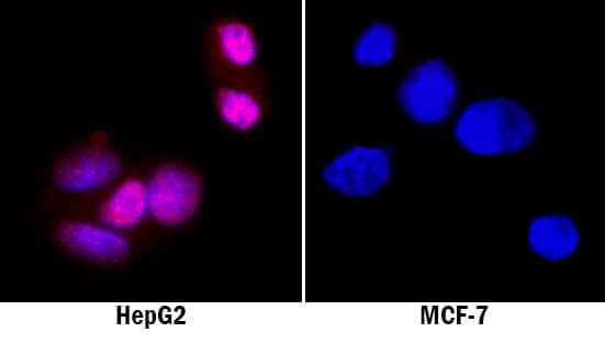 GATA-4 was detected in immersion fixed HepG2 human hepatocellular carcinoma cell line (positive staining) and MCF-7 human breast cancer cell line (negative staining) using Mouse Anti-Human GATA-4 Monoclonal Antibody (Catalog # MAB26061) at 8 µg/mL for 3 hours at room temperature. Cells were stained using the NorthernLights™ 557-conjugated Anti-Mouse IgG Secondary Antibody (red; Catalog # NL007) and counterstained with DAPI (blue). Specific staining was localized to cytoplasm and nuclei. View our protocol for Fluorescent ICC Staining of Cells on Coverslips.