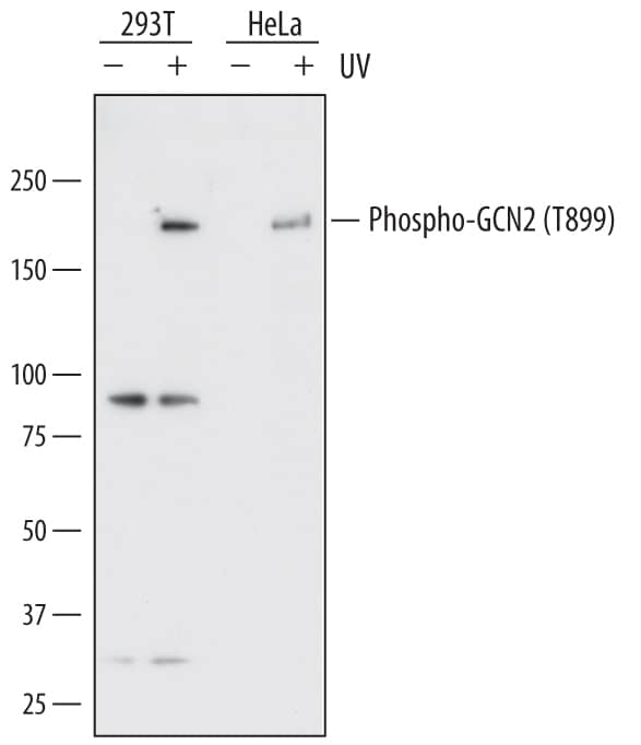 Western Blot GCN2 [p Thr899] Antibody