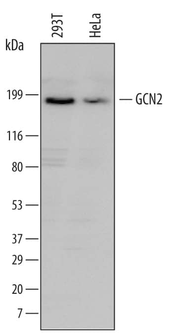 Western Blot GCN2 Antibody (708210)