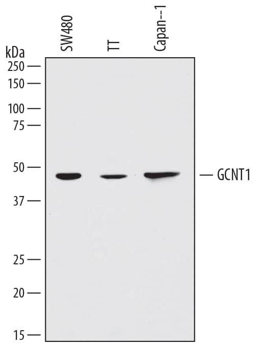 Western Blot Glucosaminyl (N-acetyl) Transferase 1/GCNT1 Antibody [Unconjugated]