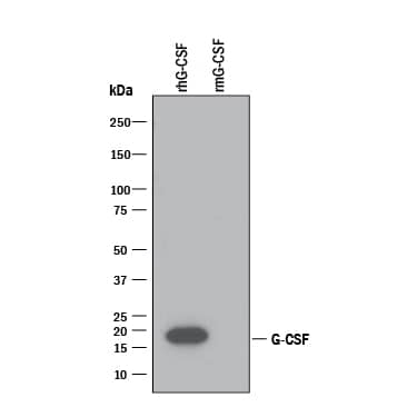 Western blot shows 25 ng of Recombinant Human G-CSF (Catalog # 214-CS) and Recombinant Mouse G-CSF (Catalog # 414-CS). PVDF Membrane was probed with 0.1 µg/mL of Goat Anti-Human G-CSF Antigen Affinity-purified Polyclonal Antibody (Catalog # AF-214-NA) followed by HRP-conjugated Anti-Goat IgG Secondary Antibody (Catalog # HAF109). A specific band was detected for G-CSF at approximately 18 kDa (as indicated). This experiment was conducted under reducing conditions and using Immunoblot Buffer Group 3.
