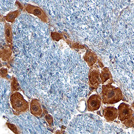 GDF-15 was detected in perfusion fixed frozen sections of mouse brain (trigeminal ganglion) using Sheep Anti-Mouse GDF-15 Antigen Affinity-purified Polyclonal Antibody (Catalog # AF6385) at 15 µg/mL overnight at 4 °C. Tissue was stained using the Anti-Sheep HRP-DAB Cell & Tissue Staining Kit (brown; Catalog # CTS019) and counterstained with hematoxylin (blue). Specific staining was localized to neuronal cytoplasm. View our protocol for Chromogenic IHC Staining of Frozen Tissue Sections.