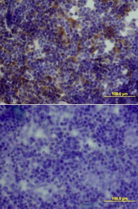 GDF-3 was detected in perfusion fixed frozen sections of mouse thymus using Mouse GDF-3 Antigen Affinity-purified Polyclonal Antibody (Catalog # AF958) at 15 µg/mL overnight at 4 °C. Tissue was stained using the Anti-Goat HRP-DAB Cell & Tissue Staining Kit (brown; Catalog # CTS008) and counterstained with hematoxylin (blue). Lower panel shows a lack of labeling if primary antibodies are omitted and tissue is stained only with secondary antibody followed by incubation with detection reagents. View our protocol for Chromogenic IHC Staining of Frozen Tissue Sections.