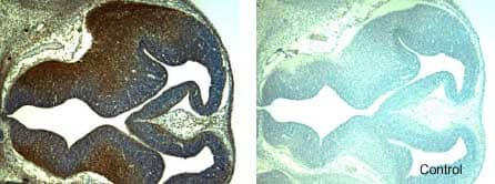 Immunohistochemistry GDF-5/BMP-14 Antibody [Unconjugated]