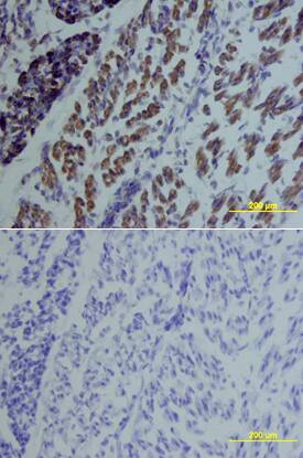 GDF-5 was detected in immersion fixed frozen sections of mouse embryo using Mouse GDF-5 Biotinylated Monoclonal Antibody (Catalog # BAM853) at 25 µg/mL overnight at 4 °C. Tissue was stained using the Anti-Rat HRP-DAB Cell & Tissue Staining Kit (brown; Catalog # CTS017) and counterstained with hematoxylin (blue). Lower panel shows a lack of labeling if primary antibodies are omitted and tissue is stained only with secondary antibody followed by incubation with detection reagents. View our protocol for Chromogenic IHC Staining of Frozen Tissue Sections.