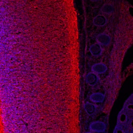 GDF-6/BMP-13 was detected in immersion fixed frozen sections of mouse embryo (E13.5) using Sheep Anti-Mouse GDF-6/ BMP-13 Antigen Affinity-purified Polyclonal Antibody (Catalog # AF855) at 10 µg/mL overnight at 4 °C. Tissue was stained using the NorthernLights™ 557-conjugated Anti-Sheep IgG Secondary Antibody (red; Catalog # NL010) and counterstained with DAPI (blue). Specific staining was localized to dorsal neural tube. View our protocol for Fluorescent IHC Staining of Frozen Tissue Sections.