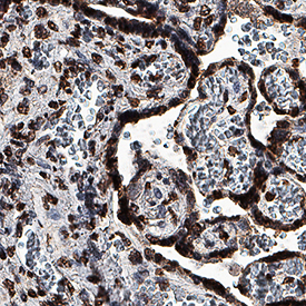 GDF-15 was detected in immersion fixed paraffin-embedded sections of human placenta using Mouse Anti-Human GDF-15 Monoclonal Antibody (Catalog # MAB9572) at 5 µg/mL for 1 hour at room temperature followed by incubation with the Anti-Mouse IgG VisUCyte™ HRP Polymer Antibody (Catalog # VC001). Before incubation with the primary antibody, tissue was subjected to heat-induced epitope retrieval using Antigen Retrieval Reagent-Basic (Catalog # CTS013). Tissue was stained using DAB (brown) and counterstained with hematoxylin (blue). Specific staining was localized to syncytiotrophoblasts. View our protocol for IHC Staining with VisUCyte HRP Polymer Detection Reagents.