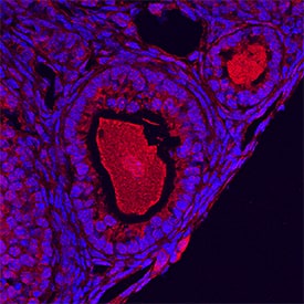GDF-9 was detected in perfusion fixed frozen sections of mouse ovary using Goat Anti-Human/Mouse/Hamster GDF-9 Antigen Affinity-purified Polyclonal Antibody (Catalog # AF739) at 5 µg/mL overnight at 4 °C. Tissue was stained using the NorthernLights™ 557-conjugated Anti-Goat IgG Secondary Antibody (red; NL001) and counterstained with DAPI (blue). Specific staining was localized to developing oocytes. View our protocol for Fluorescent IHC Staining of Frozen Tissue Sections.