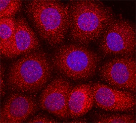 GDF-9 was detected in immersion fixed OVCAR-3 human ovarian carcinoma cell line using Mouse Anti-Human GDF-9 Monoclonal Antibody (Catalog # MAB8266) at 10 µg/mL for 3 hours at room temperature. Cells were stained using the NorthernLights™ 557-conjugated Anti-Mouse IgG Secondary Antibody (red; Catalog # NL007) and counterstained with DAPI (blue). Specific staining was localized to secreted molecule. View our protocol for Fluorescent ICC Staining of Cells on Coverslips.