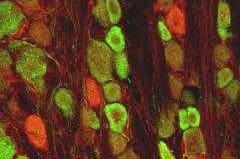 GDNF and GFRa-1 were detected in perfusion fixed frozen sections of rat dorsal root ganglia using 10 µg/mL Goat Anti-Human/Rat GDNF Antigen Affinity-purified Polyclonal Antibody (green; Catalog # AF-212-NA) and 15 µg/mL Biotinylated Goat Anti-Rat GFRa-1 Antigen Affinity-purified Polyclonal Antibody (red; Catalog # BAF560). Tissue was incubated with primary antibodies overnight at 4 °C. View our protocol for Fluorescent IHC Staining of Frozen Tissue Sections.