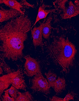 GDPD2 was detected in immersion fixed MC3T3-E1 mouse preosteoblast cell line using Mouse Anti-Human GDPD2 Monoclonal Antibody (Catalog # MAB7026) at 10 µg/mL for 3 hours at room temperature. Cells were stained using the NorthernLights™ 557-conjugated Anti-Mouse IgG Secondary Antibody (red; Catalog # NL007) and counterstained with DAPI (blue). Specific staining was localized to cytoskeleton. View our protocol for Fluorescent ICC Staining of Cells on Coverslips.
