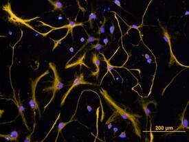 GFAP was detected in immersion fixed 7 days differentiated rat cortical stem cells using Sheep Anti-Human GFAP Antigen Affinity-purified Poly-clonal Antibody (Catalog # AF2594) at 10 µg/mL for 3 hours at room temperature. Cells were stained using the Northern-Lights™ 557-conjugated Anti-Sheep IgG Secondary Antibody (yellow; Catalog # NL010) and counterstained with DAPI (blue). View our protocol for Fluorescent ICC Staining of Cells on Coverslips.