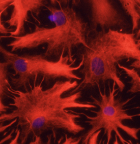 GFAP was detected in immersion fixed rat astrocytes using 10 µg/mL Sheep Anti-Human GFAP Antigen Affinity-purified Polyclonal Antibody (Catalog # AF2594) for 3 hours at room temperature. Cells were stained with the NorthernLights™ 557-conjugated Anti-Sheep IgG Secondary Antibody (red; Catalog # NL010) and counterstained with DAPI (blue). View our protocol for Fluorescent ICC Staining of Cells on Coverslips.