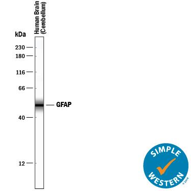 Simple Western lane view shows lysates of human brain (cerebellum) tissue, loaded at 0.2 mg/mL. A specific band was detected for GFAP at approximately 51 kDa (as indicated) using 0.1 µg/mL of Sheep Anti-Human/Rat GFAP Antigen Affinity-purified Polyclonal Antibody (Catalog # AF2594) followed by 1:50 dilution of HRP-conjugated Anti-Sheep IgG Secondary Antibody (Catalog # HAF016). This experiment was conducted under reducing conditions and using the 12-230 kDa separation system.